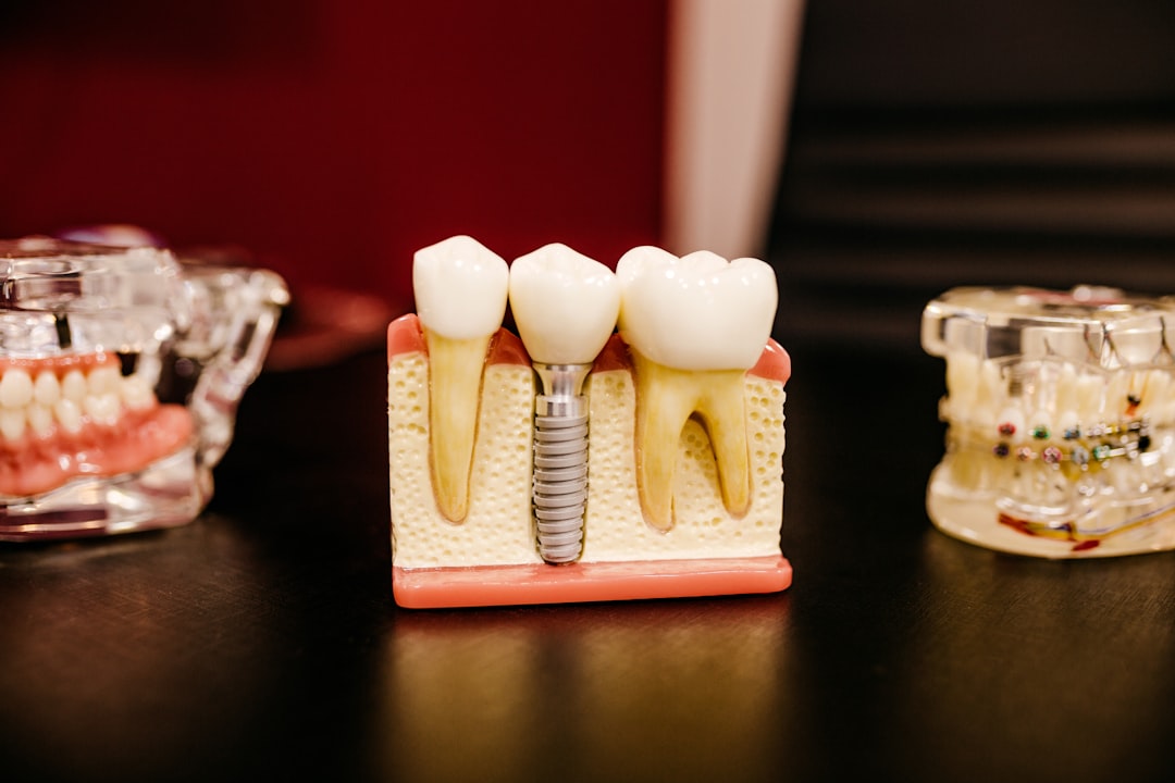 Transform Your Smile: Tooth Crown Before and After